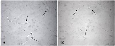 In vitro Antifungal Activity of Olive (Olea europaea) Leaf Extracts Loaded in Chitosan Nanoparticles